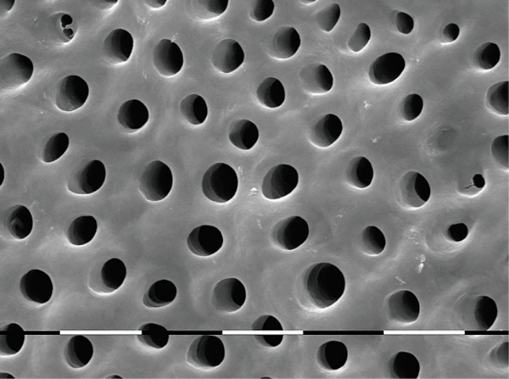 Рис. 1. Контрольная поверхность дентина. СЭМ-изображение. Увеличение X 2000.