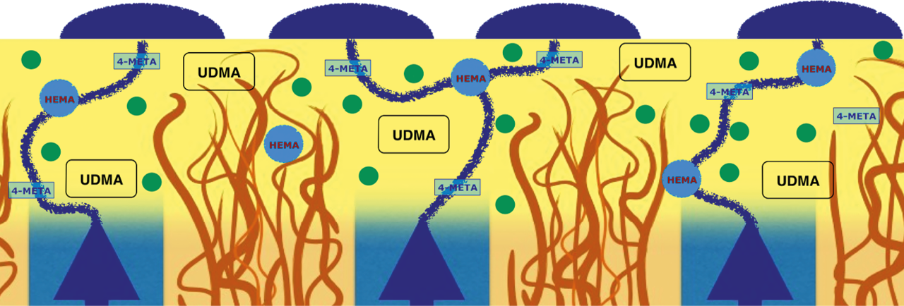 Рис. 1. Схема образования «водного дерева»: дентинная жидкость пропитывает гибридный слой через гидрофильные молекулы и выходит на поверхность.