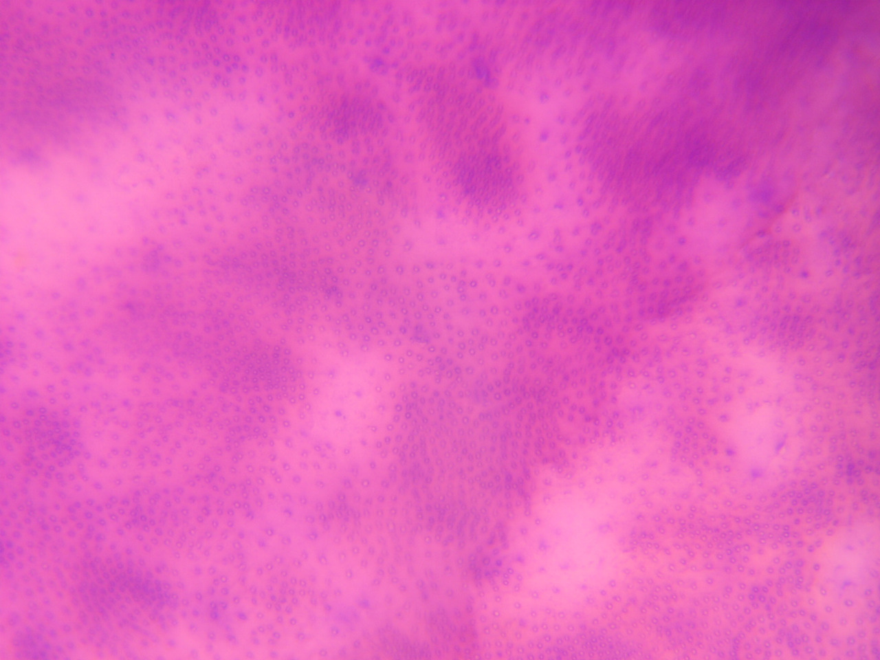 Рис. 6. Мозаичность окрашивания дентина в виде неровных овалов или пятен разной величины вследствие разной степени минерализации (окраска гематоксилином и эозином, ув.?400).