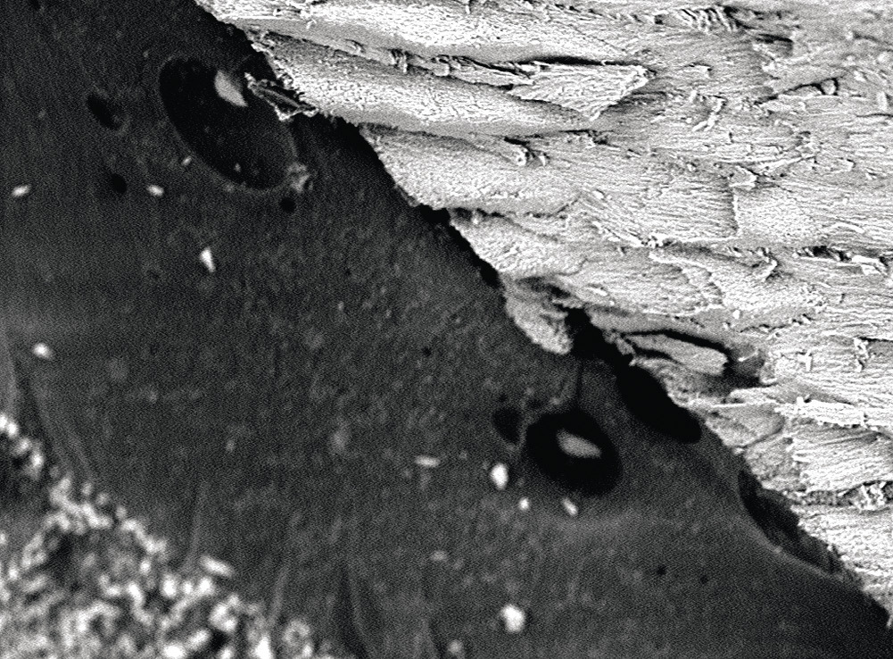 Рис. 11. Микроскопия участка границы композита с тканями зуба с наличием воздушных пор.