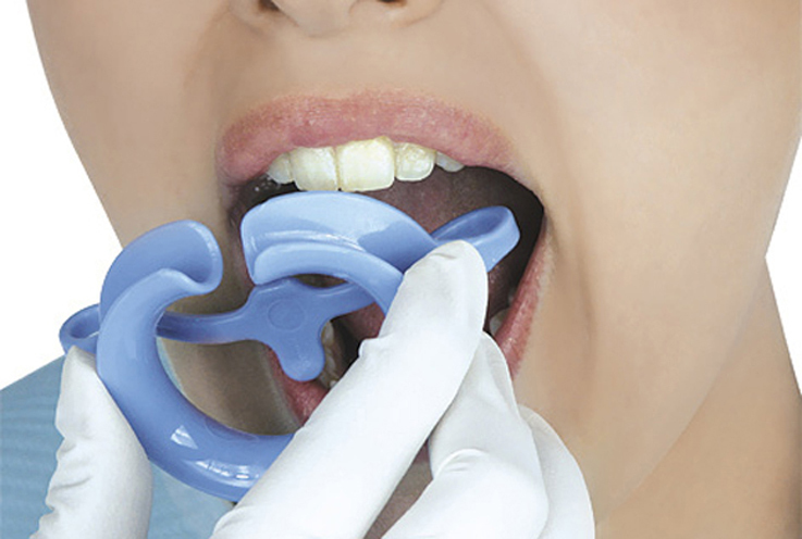1. Нанесите на губы пациента защитный крем и вставьте щечный ретрактор. Сообщите, что проглатывать слюну безопасно.