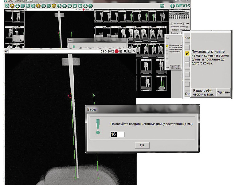 Рис. 3. Скриншот программы Dexis 6 на этапе калибровки измерений.