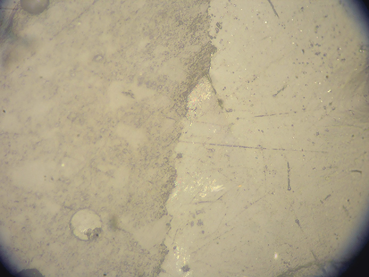 Рис. 6. Микрофотография, выполненная при увеличении 1×200 с помощью микроскопа MeF-3. Определяются незначительные дефекты на границе пломба — зуб.