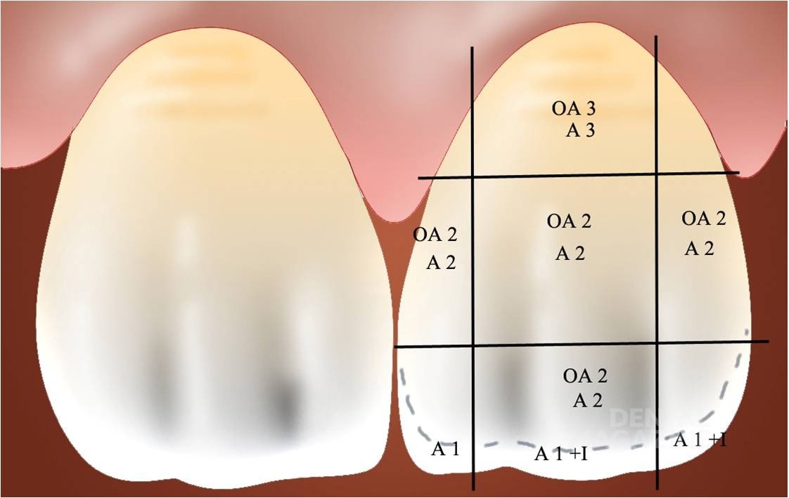 Толщина эмали переднего зуба