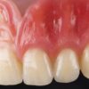 Готовая композитная десна bredent crea.lign Gel GUM после послойной характеризации