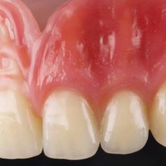 Готовая композитная десна bredent crea.lign Gel GUM после послойной характеризации